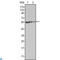 FGR Proto-Oncogene, Src Family Tyrosine Kinase antibody, LS-C814009, Lifespan Biosciences, Immunohistochemistry paraffin image 