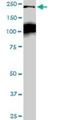 CDC42 Binding Protein Kinase Beta antibody, H00009578-M04, Novus Biologicals, Western Blot image 