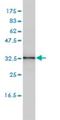 Centromere Protein K antibody, H00064105-M01, Novus Biologicals, Western Blot image 