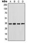 Gap Junction Protein Alpha 4 antibody, orb216118, Biorbyt, Western Blot image 