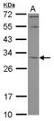 Potassium Channel Tetramerization Domain Containing 4 antibody, NBP2-17033, Novus Biologicals, Western Blot image 