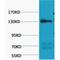 Nitric Oxide Synthase 3 antibody, LS-C387466, Lifespan Biosciences, Western Blot image 