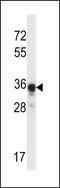 Abhydrolase Domain Containing 4 antibody, LS-C155874, Lifespan Biosciences, Western Blot image 