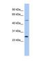 Chymotrypsinogen B1 antibody, NBP1-69699, Novus Biologicals, Western Blot image 