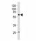 P21 (RAC1) Activated Kinase 1 antibody, F52494-0.4ML, NSJ Bioreagents, Western Blot image 