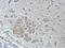 Matrix Metallopeptidase 1 antibody, orb214254, Biorbyt, Immunohistochemistry paraffin image 