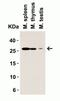 Lymphocyte Antigen 96 antibody, GTX85517, GeneTex, Western Blot image 