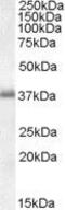 Linker For Activation Of T Cells antibody, GTX17032, GeneTex, Western Blot image 