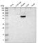 Collagen Type XVIII Alpha 1 Chain antibody, HPA011025, Atlas Antibodies, Western Blot image 
