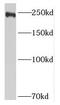 Mucin 4, Cell Surface Associated antibody, FNab05432, FineTest, Western Blot image 