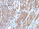 SMMHC antibody, V2748IHC-7ML, NSJ Bioreagents, Immunohistochemistry paraffin image 