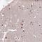 THO complex subunit 7 homolog antibody, NBP1-82076, Novus Biologicals, Immunohistochemistry paraffin image 