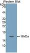Gastrin Releasing Peptide antibody, LS-C709161, Lifespan Biosciences, Western Blot image 