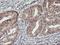 Holocarboxylase Synthetase antibody, NBP2-01859, Novus Biologicals, Immunohistochemistry paraffin image 