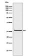 Heat Shock Protein Family B (Small) Member 1 antibody, P00676-1, Boster Biological Technology, Western Blot image 