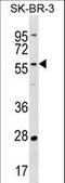 TATA-Box Binding Protein Associated Factor 6 Like antibody, LS-C157130, Lifespan Biosciences, Western Blot image 