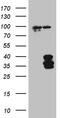 Interleukin 34 antibody, M06903-1, Boster Biological Technology, Western Blot image 