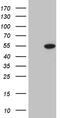 Elongator Acetyltransferase Complex Subunit 4 antibody, TA809149, Origene, Western Blot image 