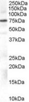 G Protein-Coupled Receptor Kinase 2 antibody, MBS420432, MyBioSource, Western Blot image 