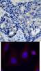 Protein Tyrosine Kinase 2 Beta antibody, 79-199, ProSci, Immunohistochemistry frozen image 