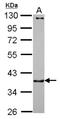Catenin alpha-3 antibody, NBP2-16030, Novus Biologicals, Western Blot image 