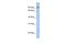 ClpB Homolog, Mitochondrial AAA ATPase Chaperonin antibody, PA5-44129, Invitrogen Antibodies, Western Blot image 