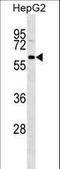 GDNF Family Receptor Alpha 3 antibody, LS-C166451, Lifespan Biosciences, Western Blot image 
