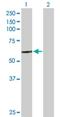 Cathepsin C antibody, H00001075-D01P, Novus Biologicals, Western Blot image 