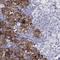 Protein Tyrosine Phosphatase Receptor Type N antibody, NBP1-83128, Novus Biologicals, Immunohistochemistry frozen image 