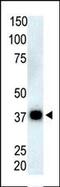 Protein Phosphatase 5 Catalytic Subunit antibody, PA5-15607, Invitrogen Antibodies, Western Blot image 