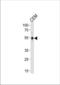 Kruppel Like Factor 5 antibody, TA324928, Origene, Western Blot image 