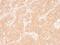 Perilipin 2 antibody, GTX34396, GeneTex, Immunohistochemistry paraffin image 
