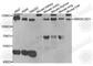 SWI/SNF-Related, Matrix-Associated Actin-Dependent Regulator Of Chromatin, Subfamily A, Containing DEAD/H Box 1 antibody, A5850, ABclonal Technology, Western Blot image 