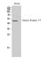 Casein Kinase 1 Delta antibody, STJ92015, St John