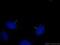 Tubulin Gamma 1 antibody, 66320-1-Ig, Proteintech Group, Immunofluorescence image 