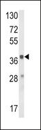 Hydroxyacid Oxidase 1 antibody, 63-542, ProSci, Western Blot image 