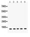 FXYD Domain Containing Ion Transport Regulator 1 antibody, PA5-79288, Invitrogen Antibodies, Western Blot image 