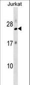 Ribosomal Protein L18 antibody, LS-C158889, Lifespan Biosciences, Western Blot image 