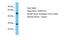 Trafficking Protein Particle Complex 10 antibody, PA5-42774, Invitrogen Antibodies, Western Blot image 