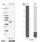 Acyl-CoA Dehydrogenase Short/Branched Chain antibody, HPA041458, Atlas Antibodies, Western Blot image 