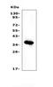 Insulin Like Growth Factor Binding Protein 2 antibody, A01373-1, Boster Biological Technology, Western Blot image 
