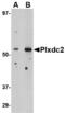 Plexin Domain Containing 2 antibody, LS-C53238, Lifespan Biosciences, Western Blot image 