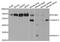 PDZ And LIM Domain 5 antibody, A5720, ABclonal Technology, Western Blot image 
