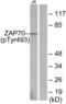 Zeta Chain Of T Cell Receptor Associated Protein Kinase 70 antibody, LS-C117511, Lifespan Biosciences, Western Blot image 