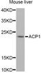 Acid Phosphatase antibody, LS-C747495, Lifespan Biosciences, Western Blot image 