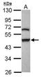 Gasdermin B antibody, GTX117760, GeneTex, Western Blot image 