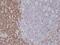 CD5 Molecule antibody, MA5-27903, Invitrogen Antibodies, Immunohistochemistry paraffin image 