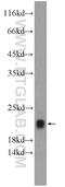 Troponin C2, Fast Skeletal Type antibody, 15875-1-AP, Proteintech Group, Western Blot image 