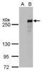 Tet Methylcytosine Dioxygenase 2 antibody, NBP2-43682, Novus Biologicals, Western Blot image 