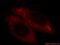 Myristoylated Alanine Rich Protein Kinase C Substrate antibody, 20661-1-AP, Proteintech Group, Immunofluorescence image 